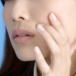 【体験談】顔にできるニキビの種類と原因その予防方法と改善方法