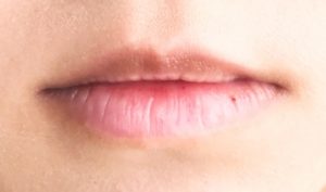 唇にシワができる原因と予防改善法 しわ隠すワンポイントアドバイス